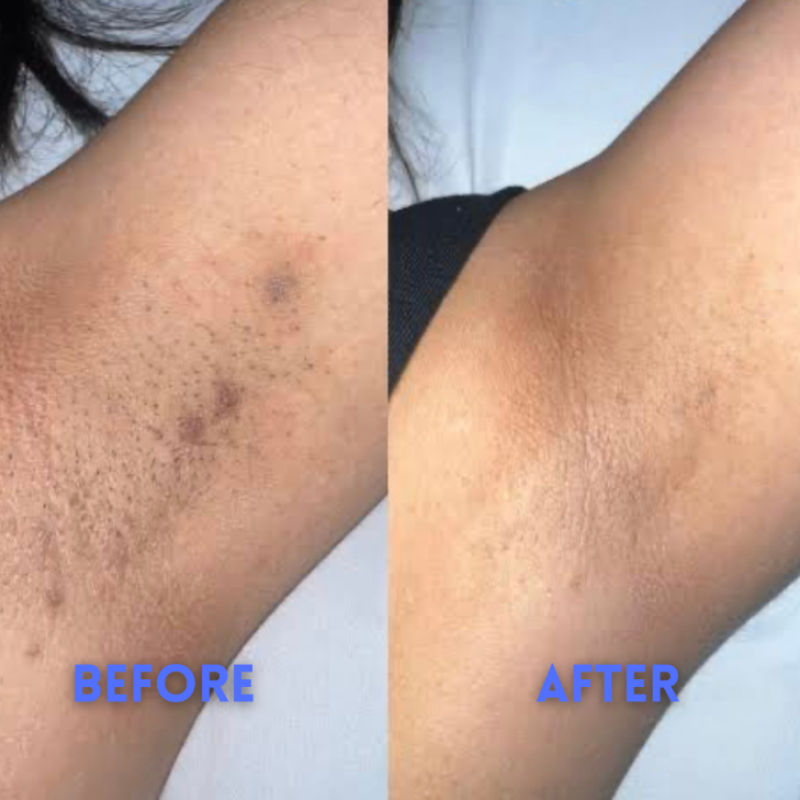 SmoothAway - Smooth Skin, Roll-on Serum