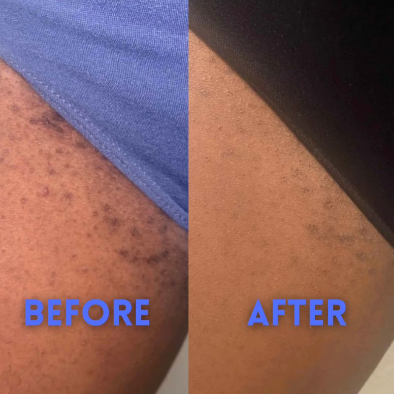 SmoothAway - Smooth Skin, Roll-on Serum