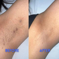 SmoothAway - Smooth Skin, Roll-on Serum